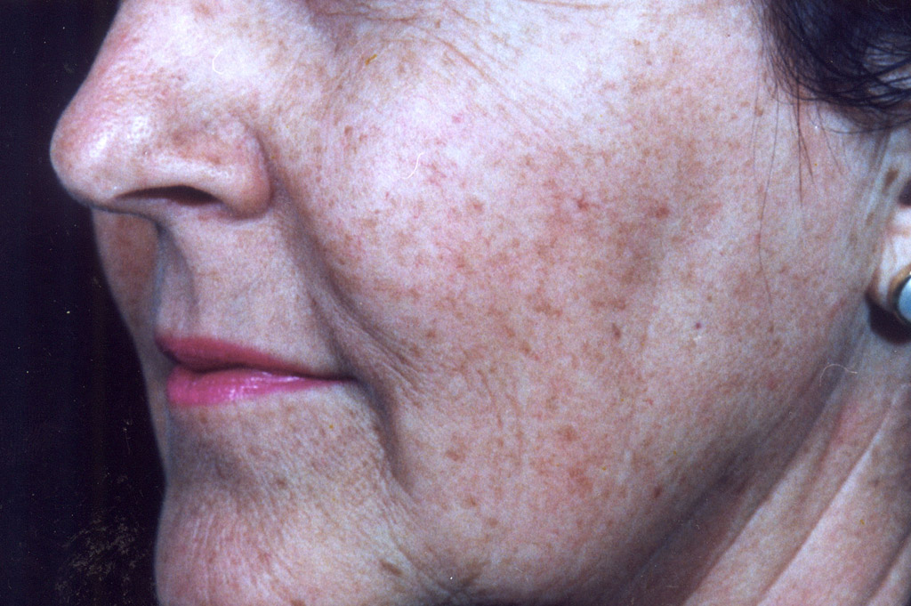 Environ Skin Care Ageing Before